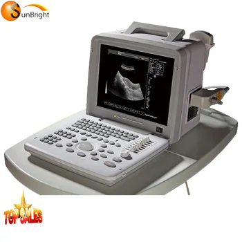 Personālo DATORU portatīvo ultraskaņas mašīna medicīniskās ultraskaņas ierīces, Saules 806X